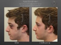 trauma repair before and after